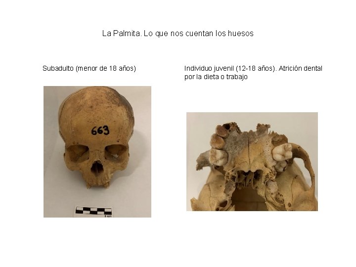 La Palmita. Lo que nos cuentan los huesos Subadulto (menor de 18 años) Individuo