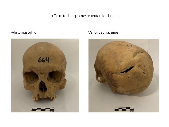 La Palmita. Lo que nos cuentan los huesos Adulto masculino Varios traumatismos 