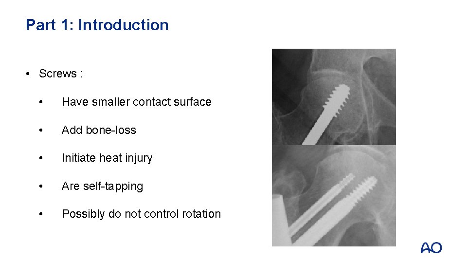 Part 1: Introduction • Screws : • Have smaller contact surface • Add bone-loss