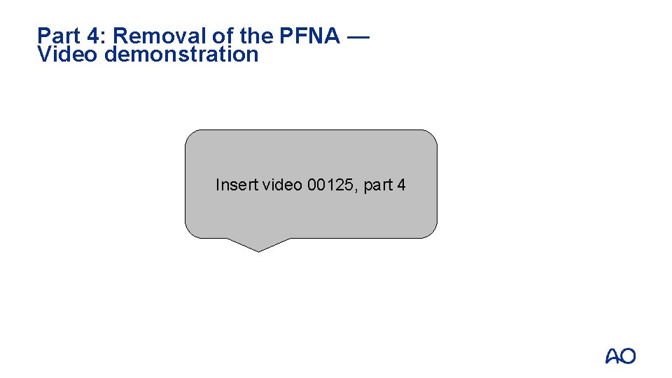 Part 4: Removal of the PFNA — Video demonstration Insert video 00125, part 4