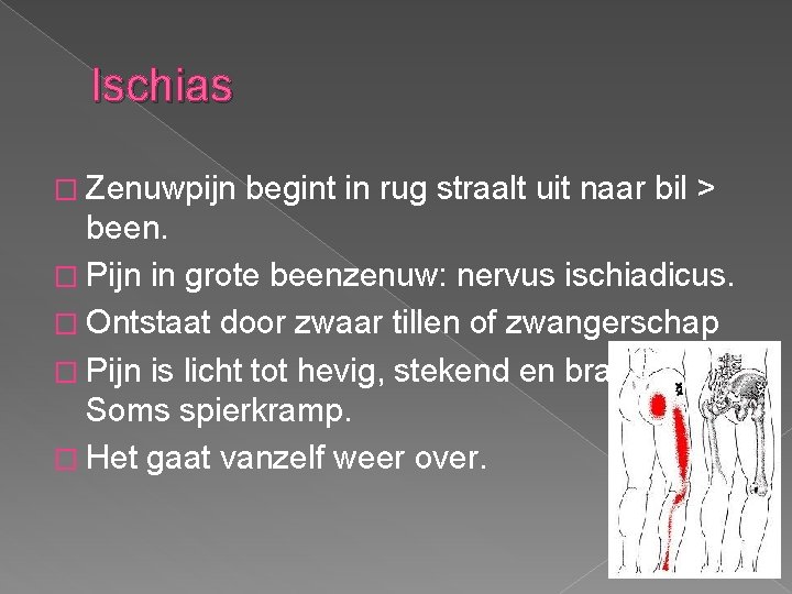 Ischias � Zenuwpijn begint in rug straalt uit naar bil > been. � Pijn