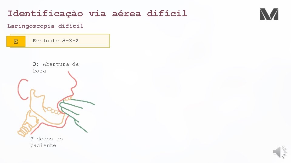 Identificação via aérea difícil Laringoscopia difícil E Evaluate 3 -3 -2 3: Abertura da