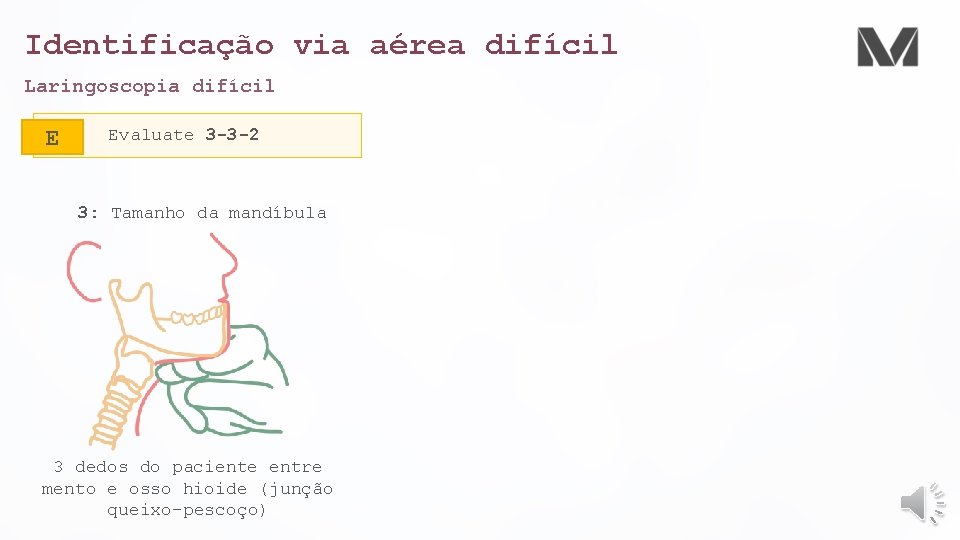 Identificação via aérea difícil Laringoscopia difícil E Evaluate 3 -3 -2 3: Tamanho da