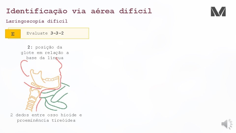 Identificação via aérea difícil Laringoscopia difícil E Evaluate 3 -3 -2 2: posição da