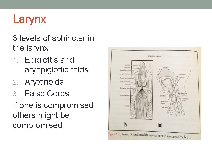 Larynx 3 levels of sphincter in the larynx 1. Epiglottis and aryepiglottic folds 2.