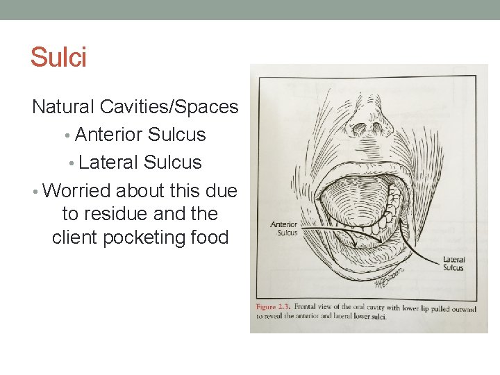 Sulci Natural Cavities/Spaces • Anterior Sulcus • Lateral Sulcus • Worried about this due