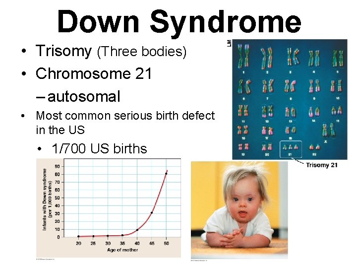 Down Syndrome • Trisomy (Three bodies) • Chromosome 21 – autosomal • Most common