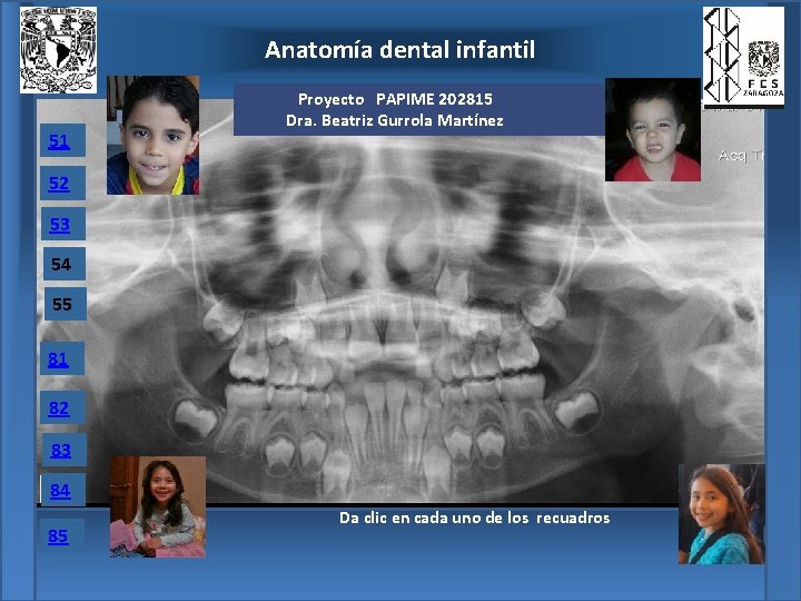 Anatomía dental infantil 51 Proyecto PAPIME 202815 Dra. Beatriz Gurrola Martínez 52 53 54