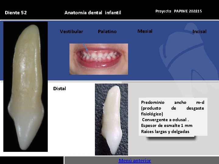 Diente 52 Proyecto PAPIME 202815 Anatomía dental infantil Vestibular Palatino Mesial Incisal Distal Predominio