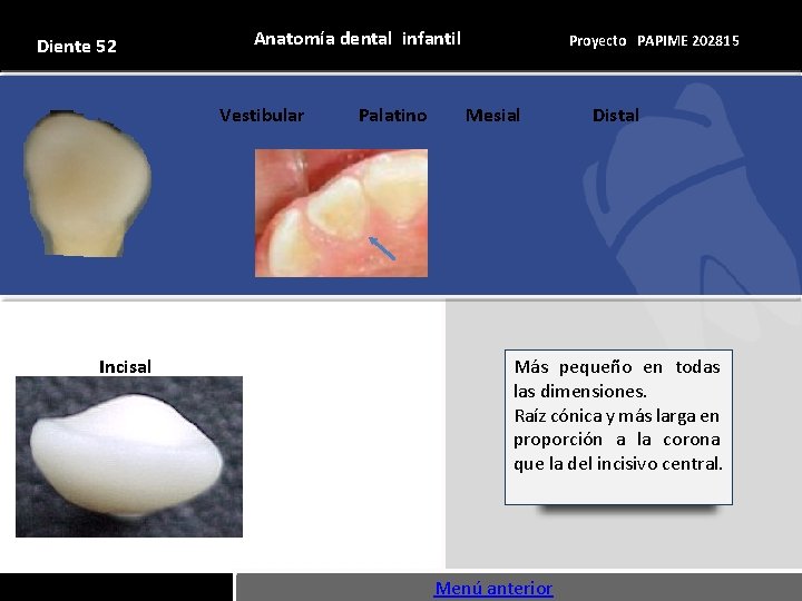 Diente 52 Anatomía dental infantil Vestibular Incisal Palatino Proyecto PAPIME 202815 Mesial Distal Más