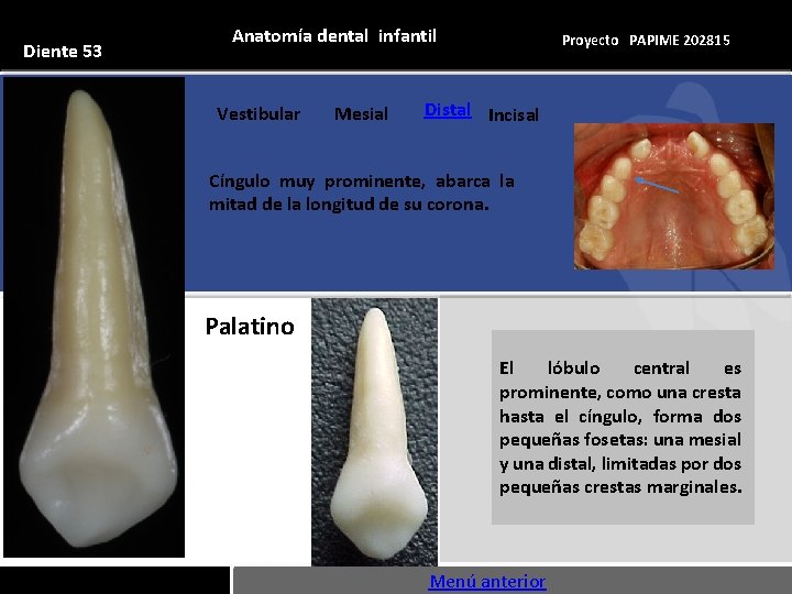 Diente 53 Anatomía dental infantil Vestibular Mesial Proyecto PAPIME 202815 Distal Incisal Cíngulo muy