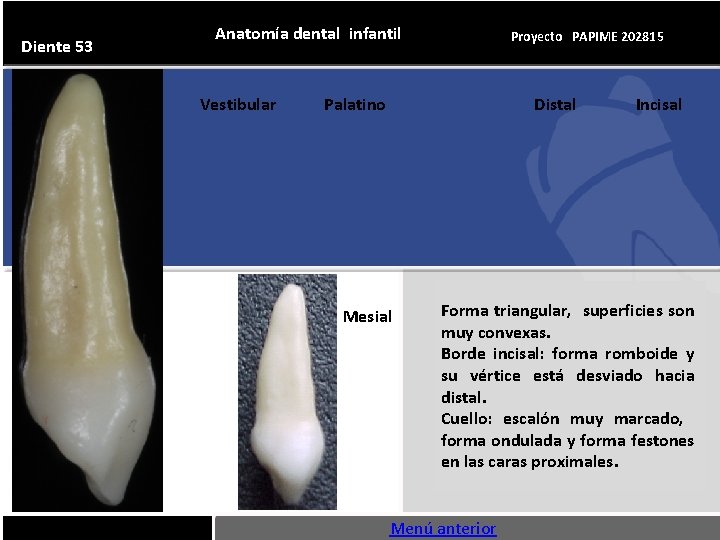 Diente 53 Anatomía dental infantil Vestibular Proyecto PAPIME 202815 Palatino Distal Mesial Incisal Forma