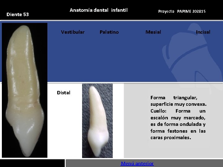 Diente 53 Anatomía dental infantil Vestibular Distal Palatino Proyecto PAPIME 202815 Mesial Incisal Forma