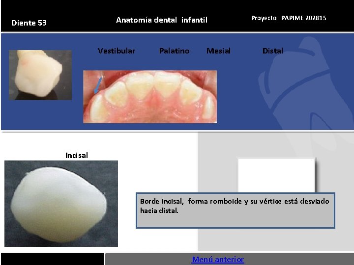 Anatomía dental infantil Diente 53 Vestibular Palatino Mesial Proyecto PAPIME 202815 Distal Incisal Borde