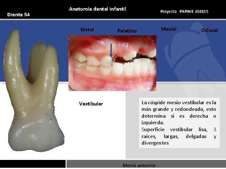Anatomía dental infantil Diente 54 Distal Anatomía dental infantil Proyecto PAPIME 202815 Mesial Palatino
