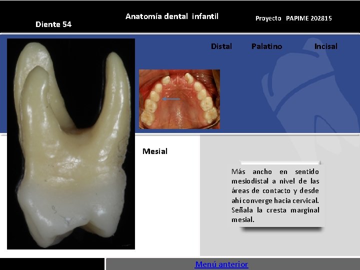 Diente 54 Anatomía dental infantil Proyecto PAPIME 202815 Distal Palatino Incisal Mesial Más ancho