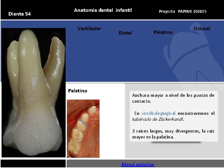 Diente 54 Anatomía dental infantil Vestibular Palatino Distal Proyecto PAPIME 202815 Palatino Oclusal Anchura