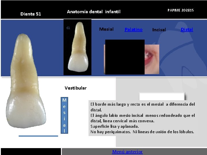 PAPIME 202815 Anatomía dental infantil Diente 51 61 Mesial Palatino Incisal Distal Vestibular M