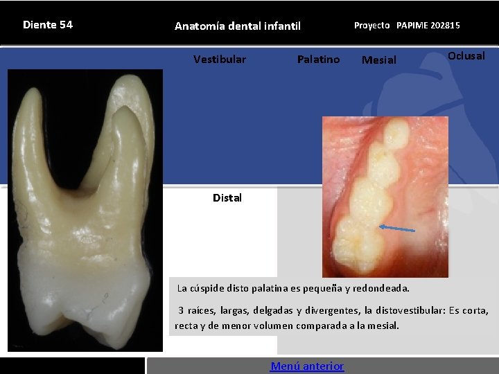 Diente 54 Anatomía dental infantil Vestibular Palatino Proyecto PAPIME 202815 Mesial Oclusal Distal La