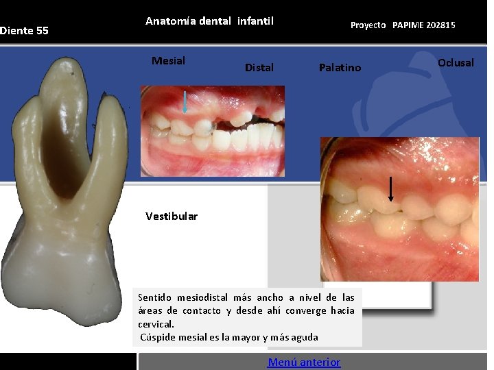 Diente 55 Anatomía dental infantil Mesial Distal Proyecto PAPIME 202815 Palatino Vestibular Sentido mesiodistal