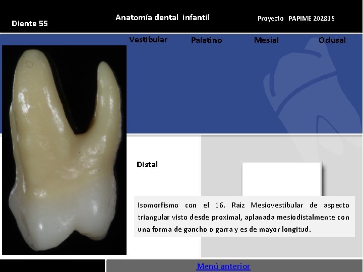 Diente 55 Anatomía dental infantil Vestibular Palatino Proyecto PAPIME 202815 Mesial Oclusal Distal Isomorfismo
