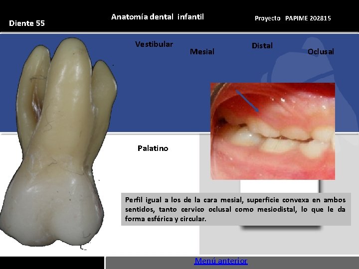 Diente 55 Anatomía dental infantil Vestibular Mesial Proyecto PAPIME 202815 Distal Oclusal Palatino Perfil