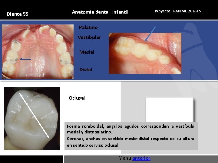 Diente 55 Anatomía dental infantil Proyecto PAPIME 202815 Palatino Vestibular Mesial Distal Oclusal Forma