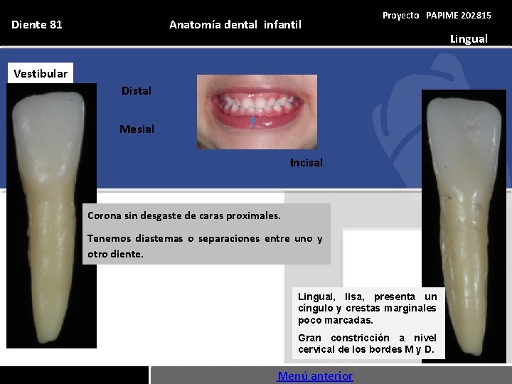 Anatomía dental infantil Diente 81 Proyecto PAPIME 202815 Vestibular Distal Mesial Incisal Corona sin