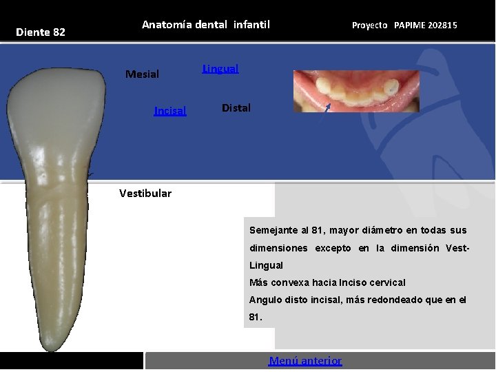 Diente 82 Anatomía dental infantil Mesial Incisal Proyecto PAPIME 202815 Lingual Distal Vestibular Semejante