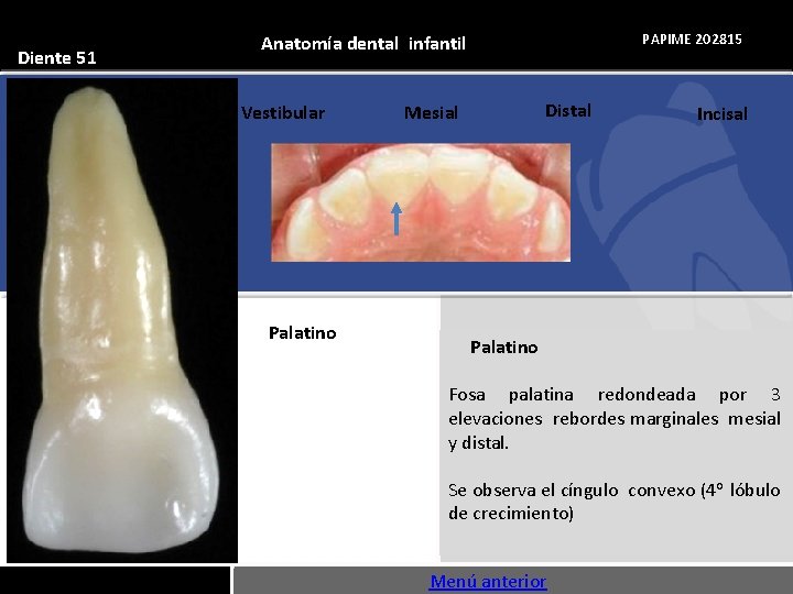 Diente 51 PAPIME 202815 Anatomía dental infantil Vestibular Palatino Distal Mesial Incisal Palatino Fosa