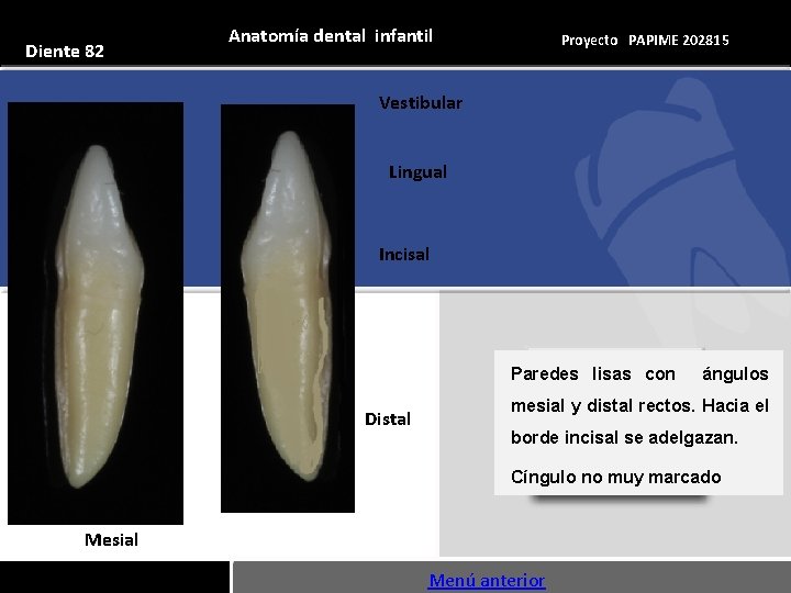 Diente 82 Anatomía dental infantil Proyecto PAPIME 202815 Vestibular Lingual Incisal Paredes lisas con