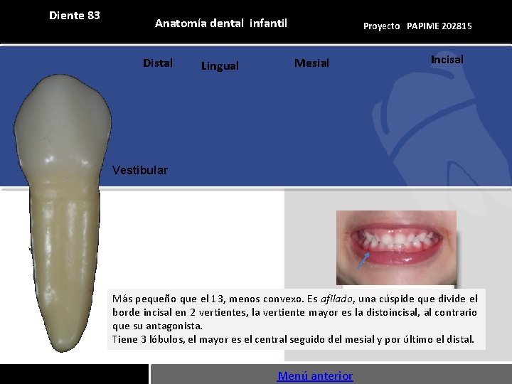 Diente 83 Anatomía dental infantil Distal Lingual Proyecto PAPIME 202815 Mesial Incisal Vestibular Más