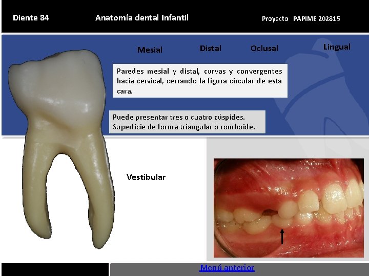 Diente 84 Anatomía dental Infantil Mesial Proyecto PAPIME 202815 Distal Oclusal Paredes mesial y