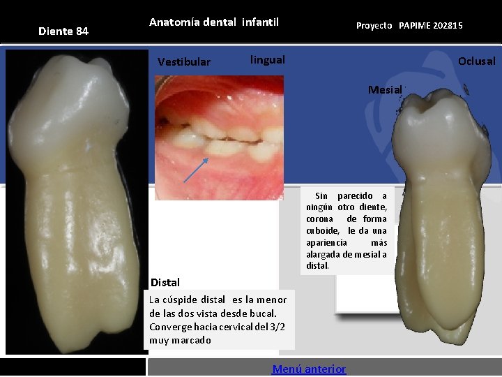Diente 84 Anatomía dental infantil Vestibular Proyecto PAPIME 202815 lingual Oclusal Mesial Sin parecido