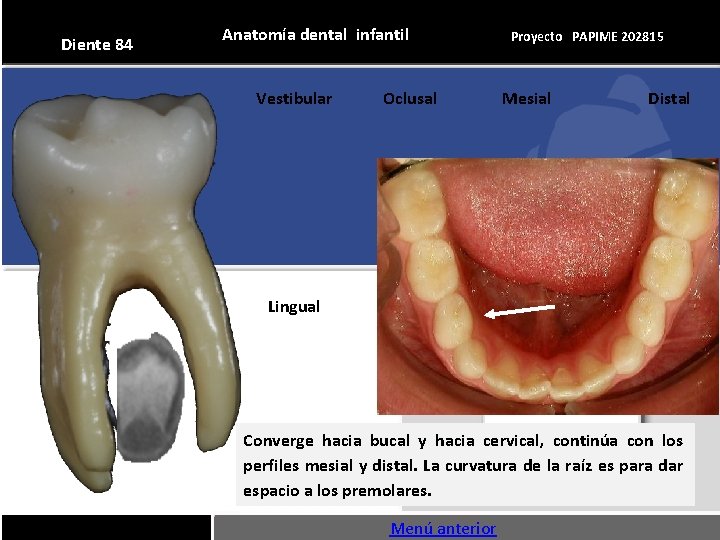 Diente 84 Anatomía dental infantil Vestibular Oclusal Proyecto PAPIME 202815 Mesial Distal Lingual Converge