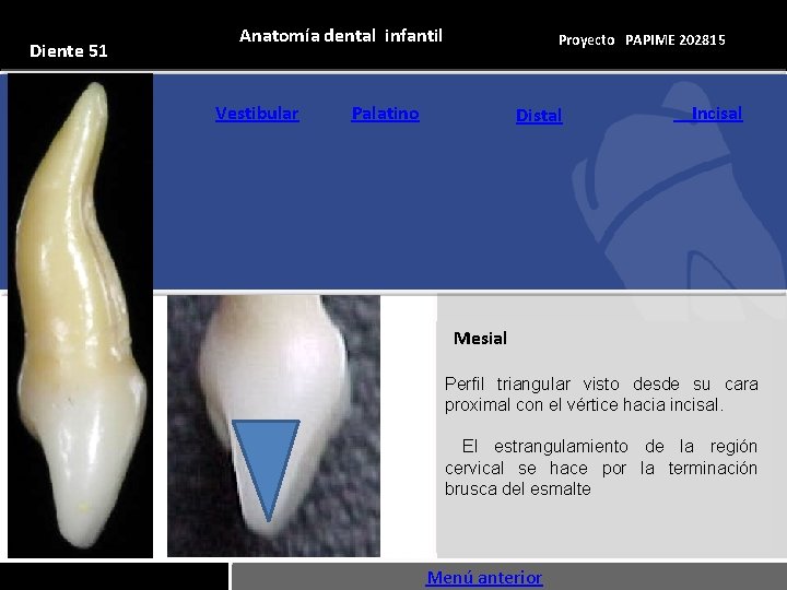 Diente 51 Anatomía dental infantil Vestibular Proyecto PAPIME 202815 Palatino Distal Incisal Mesial Perfil