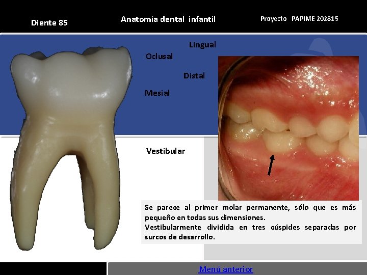 Diente 85 Anatomía dental infantil Proyecto PAPIME 202815 Lingual Oclusal Distal Mesial Vestibular Se