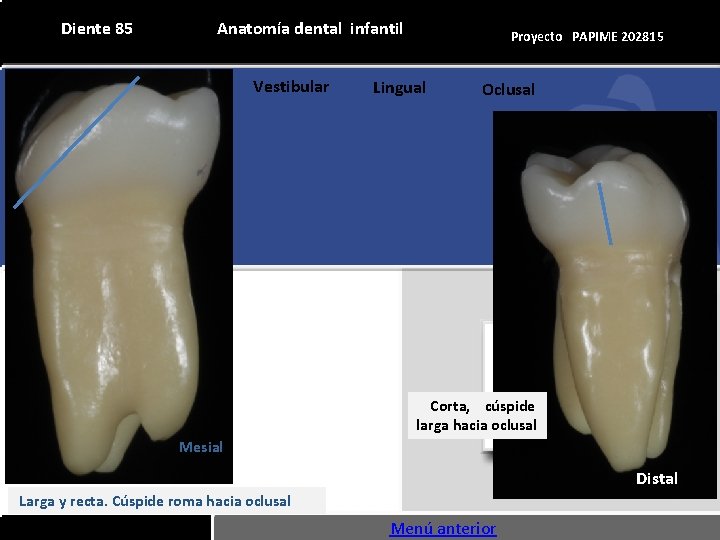 Diente 85 Diente 51 Anatomía dental infantil Vestibular Mesial Anatomía Proyectodental PAPIMEinfantil 202815 Lingual.