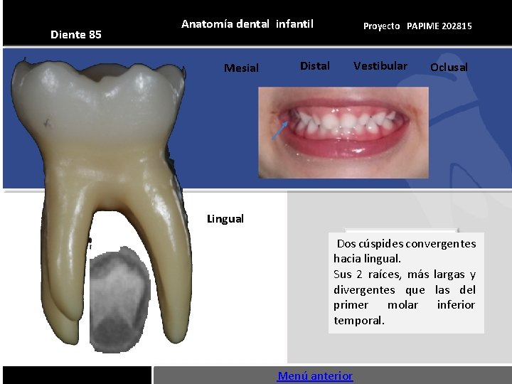 Diente 85 Anatomía dental infantil Mesial Proyecto PAPIME 202815 Distal Vestibular Oclusal Lingual Dos