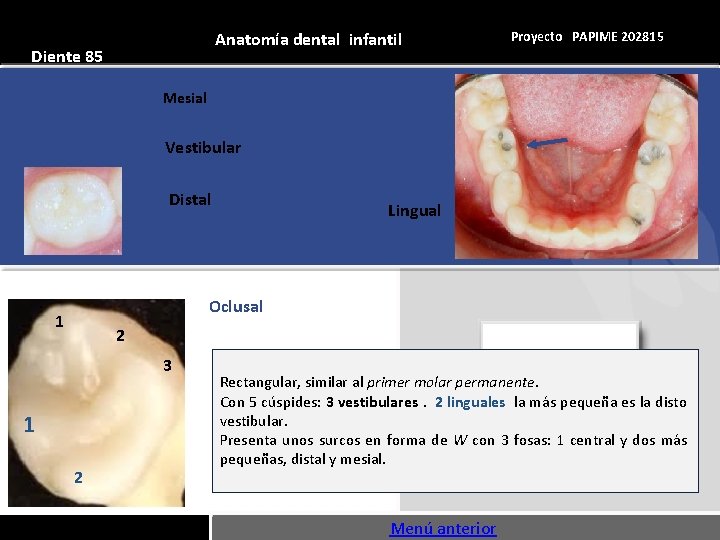 Anatomía dental infantil Diente 85 Proyecto PAPIME 202815 Mesial Vestibular Distal Lingual Oclusal 1