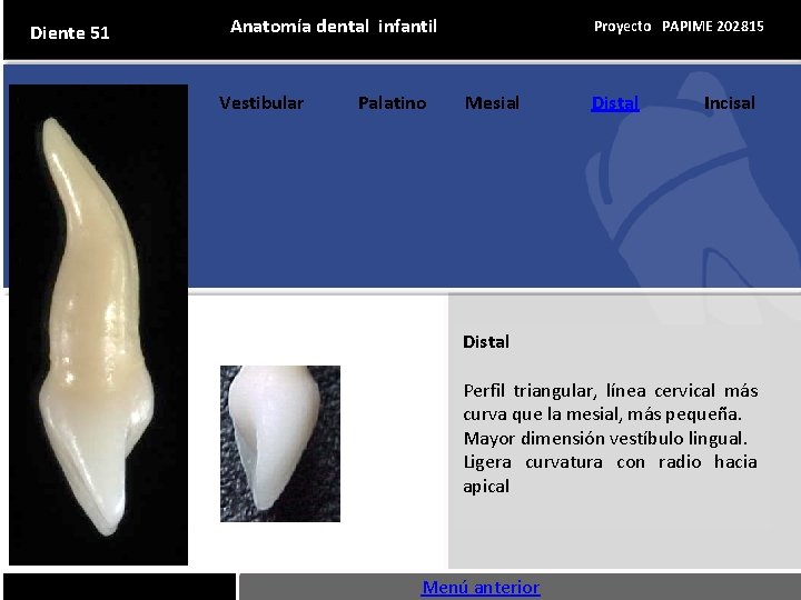 Diente 51 Anatomía dental infantil Vestibular Palatino Proyecto PAPIME 202815 Mesial Distal Incisal Distal