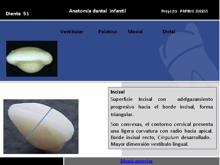 Diente 51 Anatomía dental infantil Vestibular Palatino Proyecto PAPIME 202815 Mesial Distal Incisal Superficie