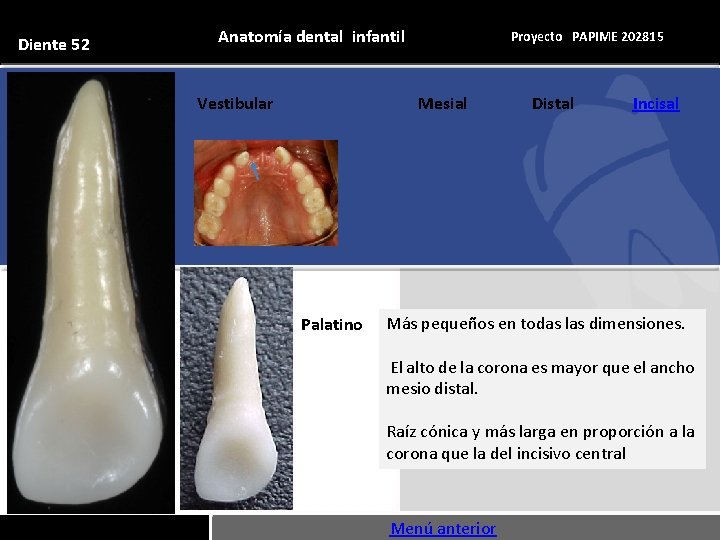 Diente 52 Anatomía dental infantil Vestibular Proyecto PAPIME 202815 Mesial Palatino Distal Incisal Más