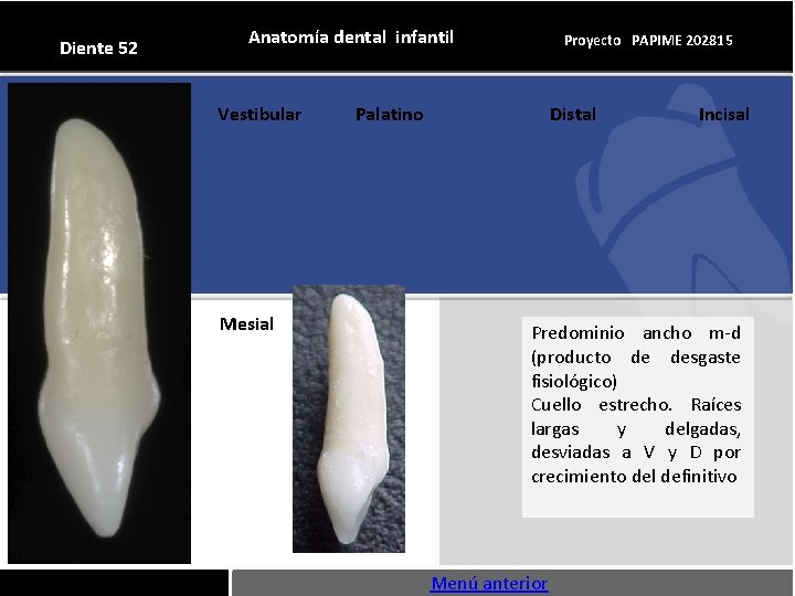 Diente 52 Anatomía dental infantil Vestibular Mesial Proyecto PAPIME 202815 Palatino Distal Incisal Predominio