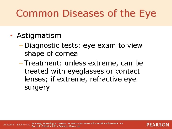 Common Diseases of the Eye • Astigmatism – Diagnostic tests: eye exam to view