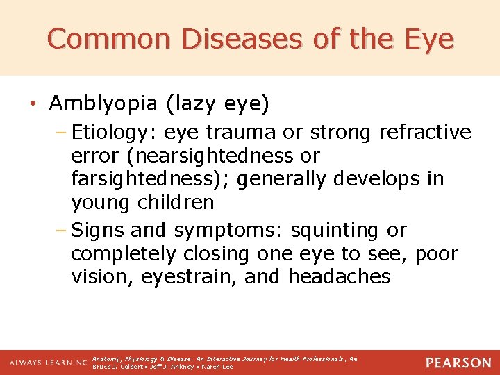 Common Diseases of the Eye • Amblyopia (lazy eye) – Etiology: eye trauma or