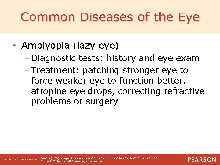 Common Diseases of the Eye • Amblyopia (lazy eye) – Diagnostic tests: history and