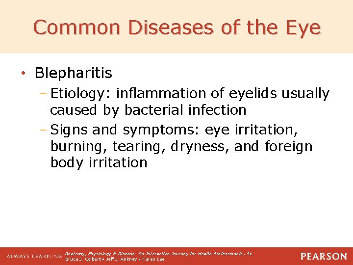 Common Diseases of the Eye • Blepharitis – Etiology: inflammation of eyelids usually caused