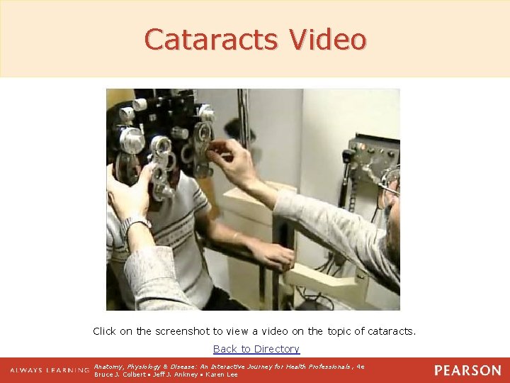 Cataracts Video Click on the screenshot to view a video on the topic of