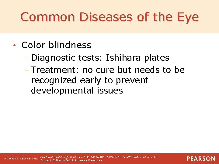 Common Diseases of the Eye • Color blindness – Diagnostic tests: Ishihara plates –
